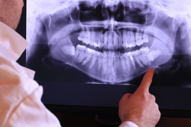 Best Emergency Gum Treatment in USA